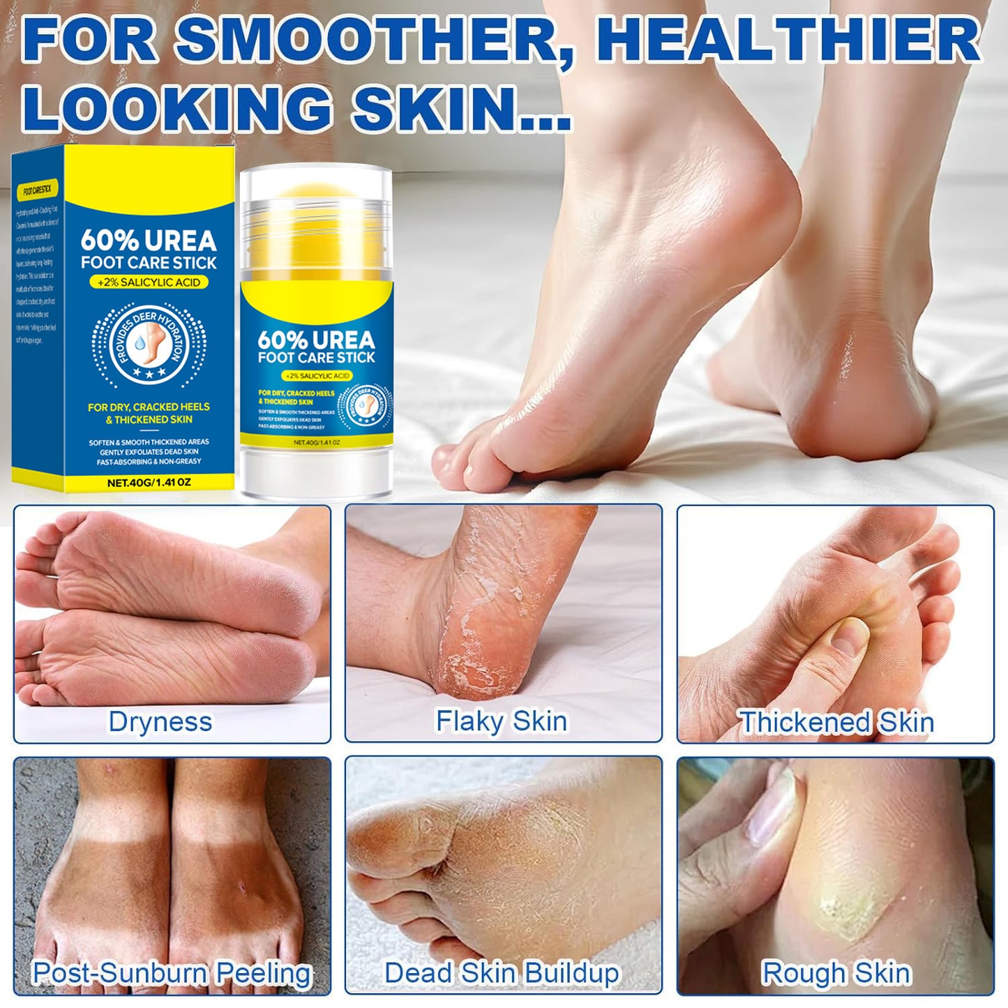 Salicylic Acid & Urea Hand and Foot Care Stick – Anti-Crack Moisturizing Balm