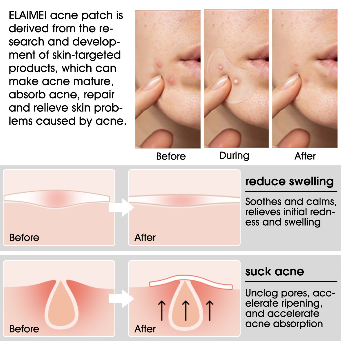 Elaimei Tea Tree Invisible Acne Pimple Patches