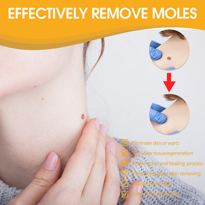 Ximonth Bee Venom Skin Tag Care Cream – Gentle Moisturizing Formula 59g