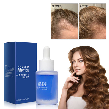 Blue Copper Peptide Hair Essence – Hair Growth & Scalp Care Serum 30ml