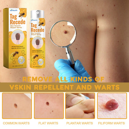 Ximonth Bee Venom Skin Tag Care Cream – Gentle Moisturizing Formula 59g